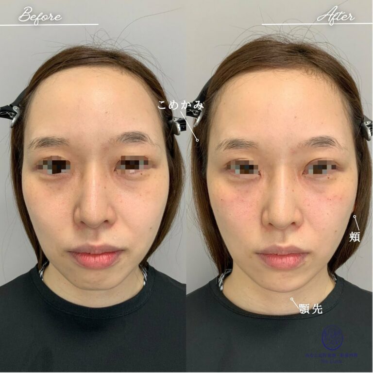 instagram-01-281