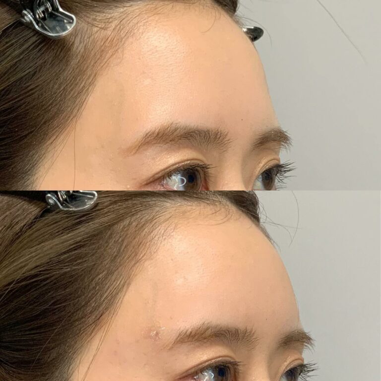instagram-01-290