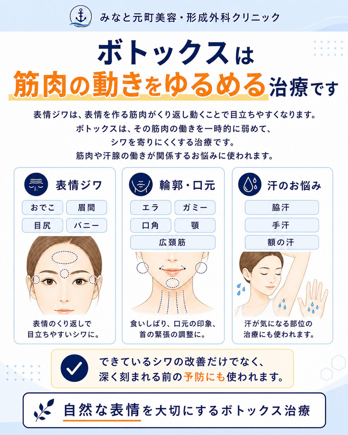 ボトックスは、「シワを消す注射」というより、筋肉の動きを一時的にゆるめる治療です💉表情ジワは、笑う、眉を寄せる、目を開ける、額を上げる
