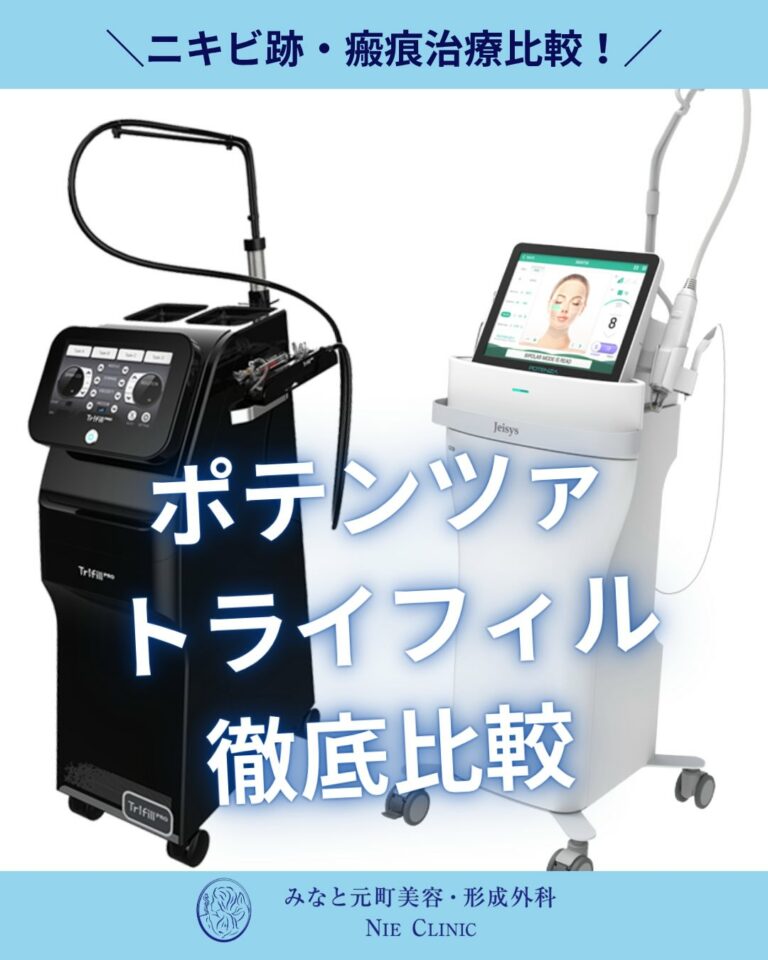 ニキビ跡治療で使うポテンツァ・トライフィルプロ・薬剤の違いの関連記事サムネイル