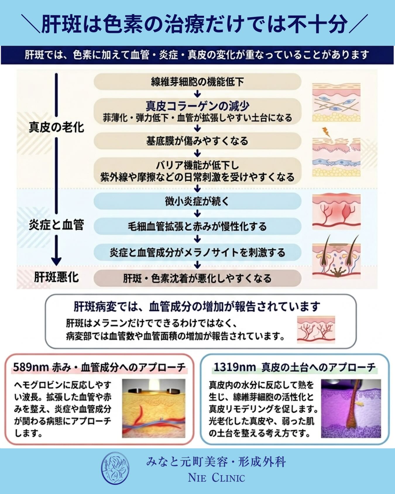 肝斑が治らないのは、真皮の老化と赤みのせい?