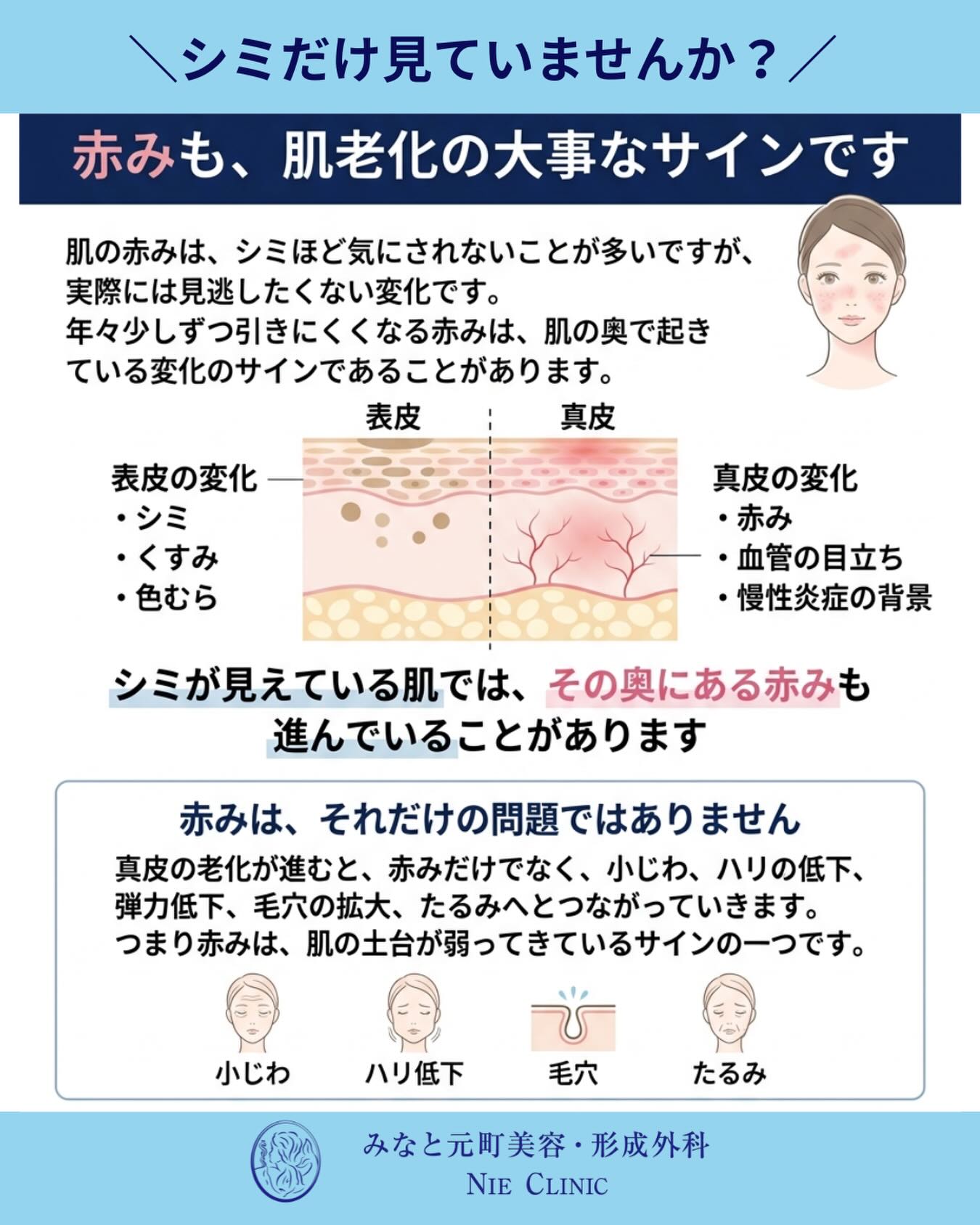 肌の赤み、気にしてる?🤔