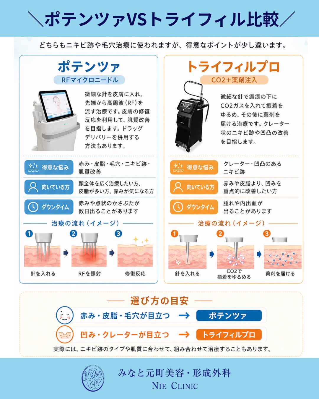 ニキビ跡治療でよくご相談の多い