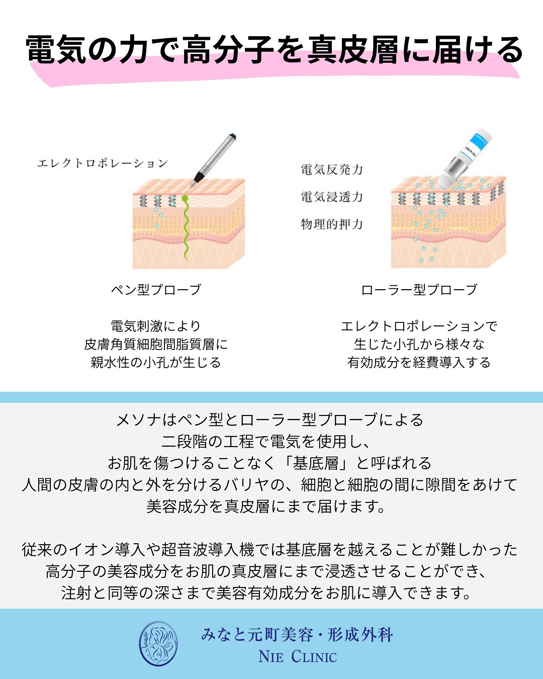 メソナJのご紹介