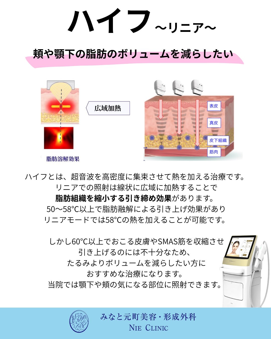 たるみ治療の比較