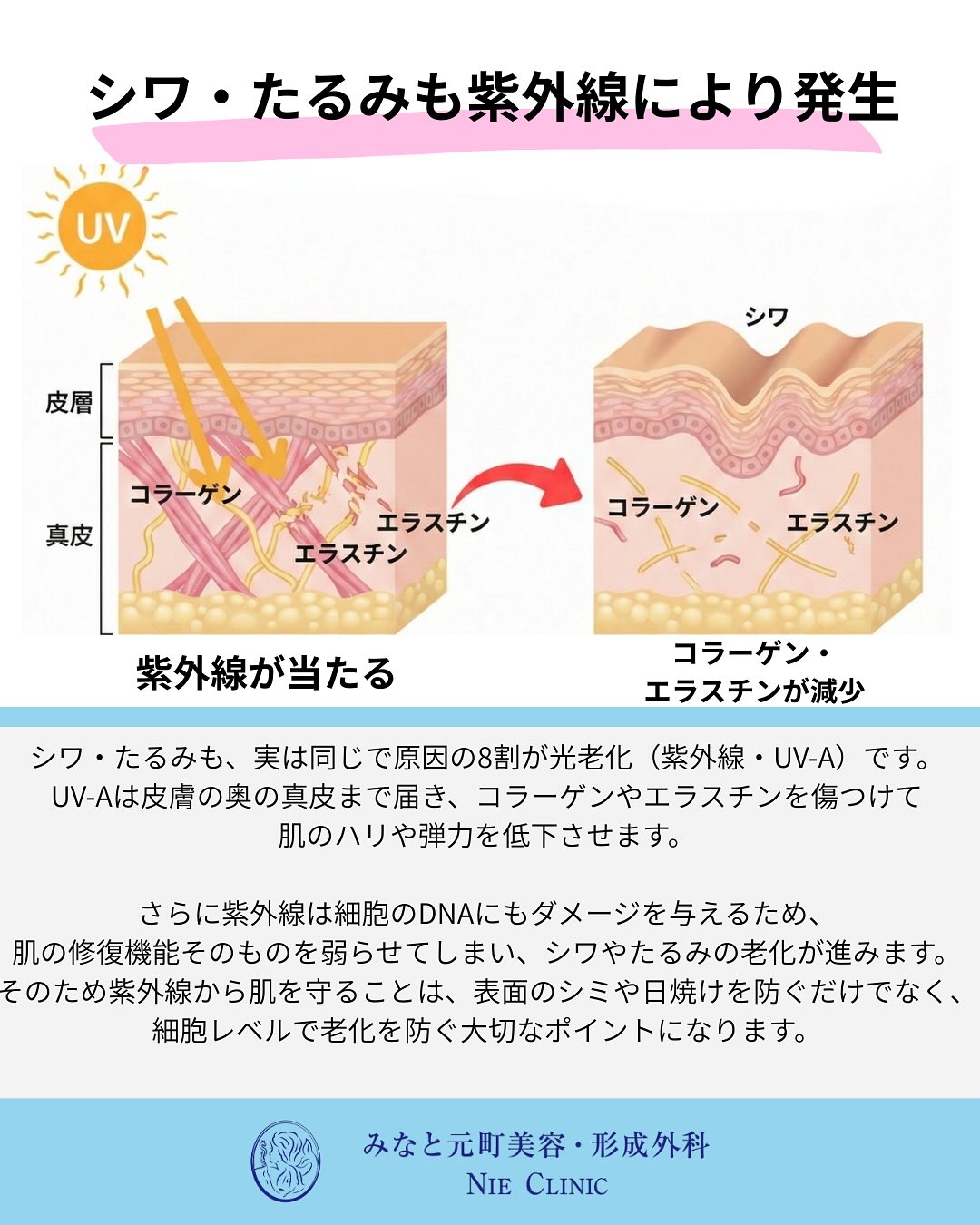 光老化と肌変化の関係