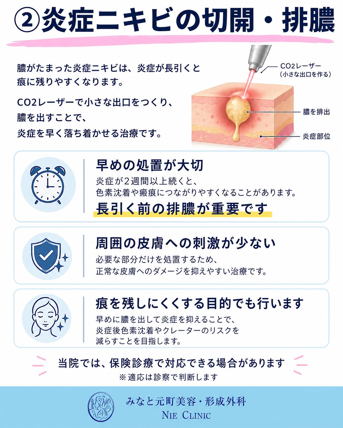 《ニキビ・ニキビ跡治療》についてまとめました