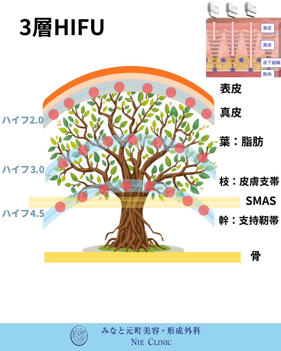 Alltite導入のお知らせ