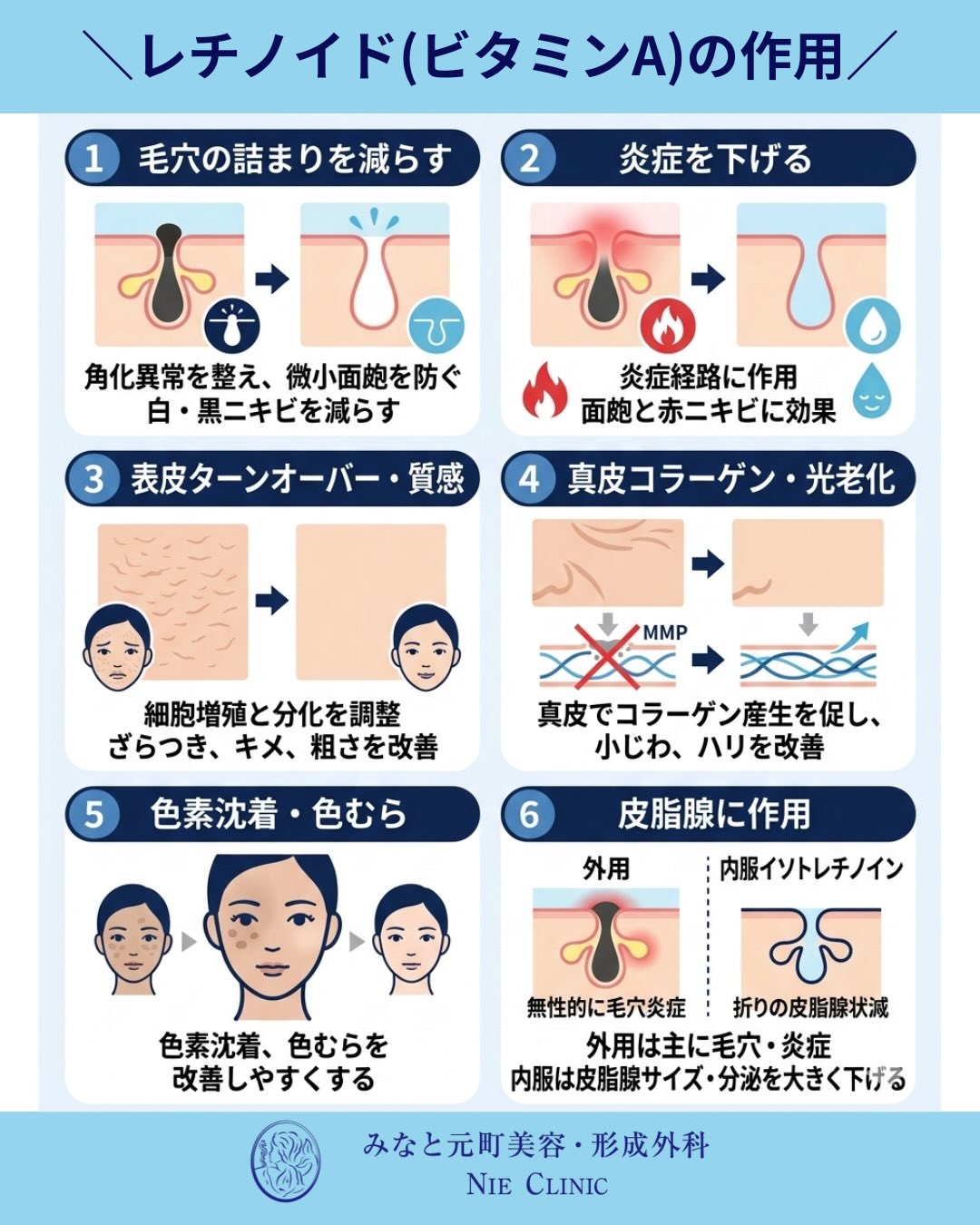 大人ニキビの複雑な要因と、適切な治療およびスキンケアのアプローチについて解説します🩺