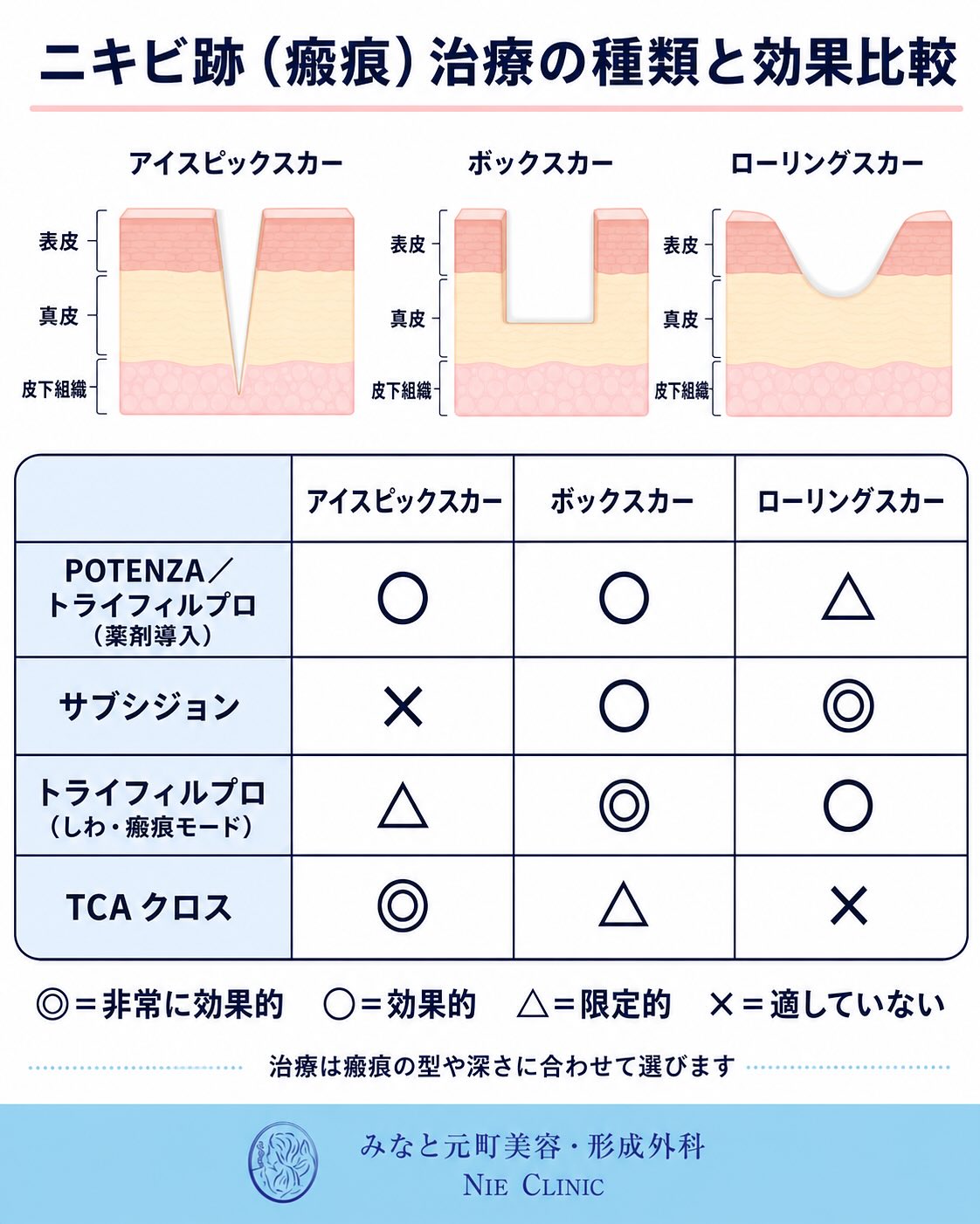 《ニキビ・ニキビ跡治療》についてまとめました
