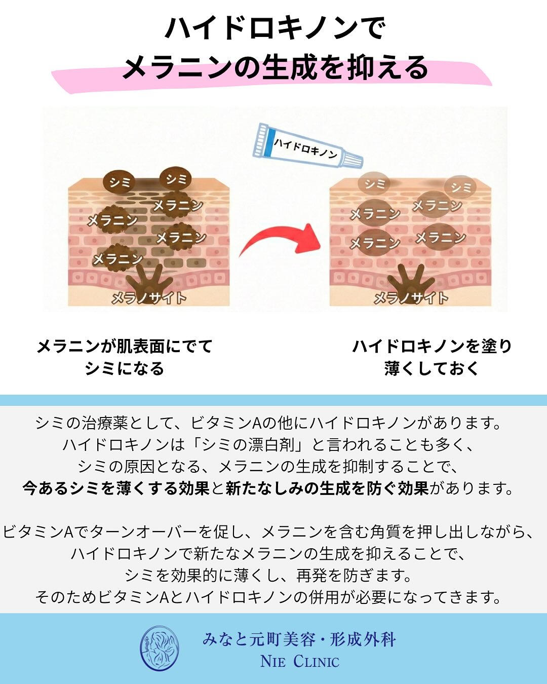 光老化と肌変化の関係