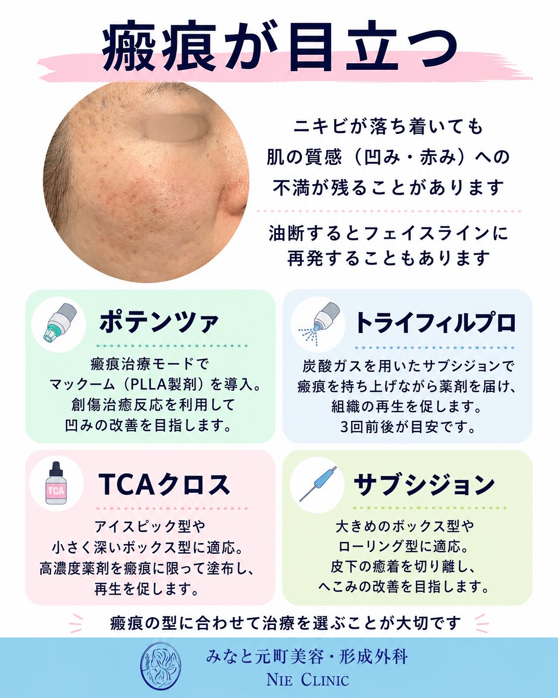 《ニキビ・ニキビ跡治療》についてまとめました