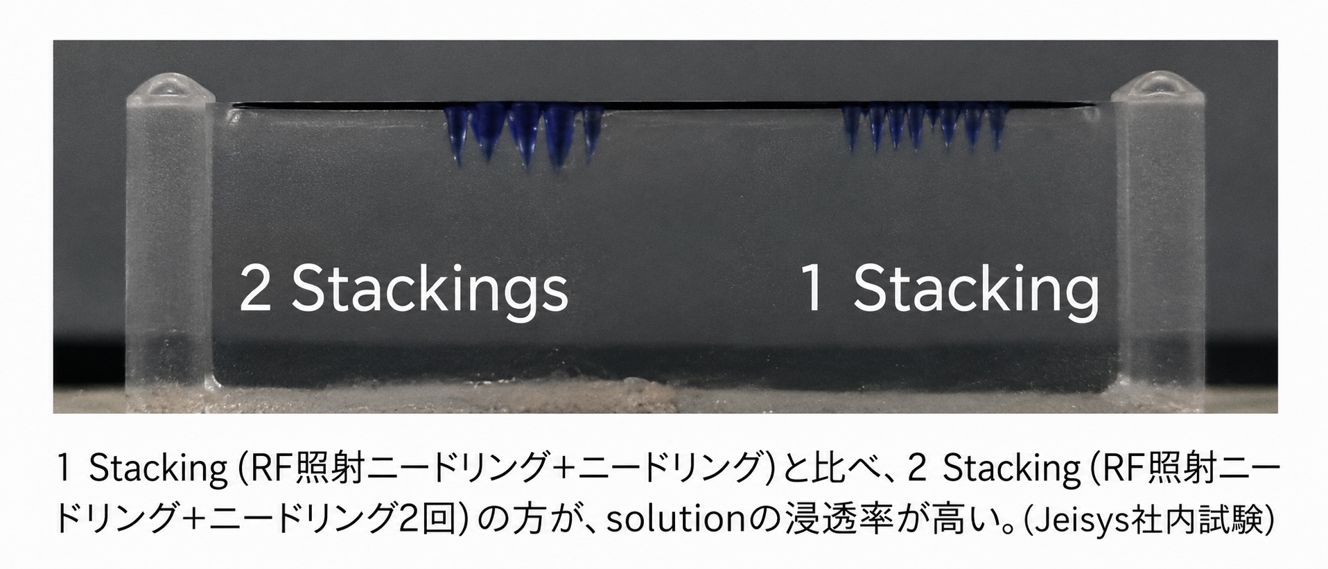 1 Stackingと2 Stackingsにおけるsolution浸透率の比較