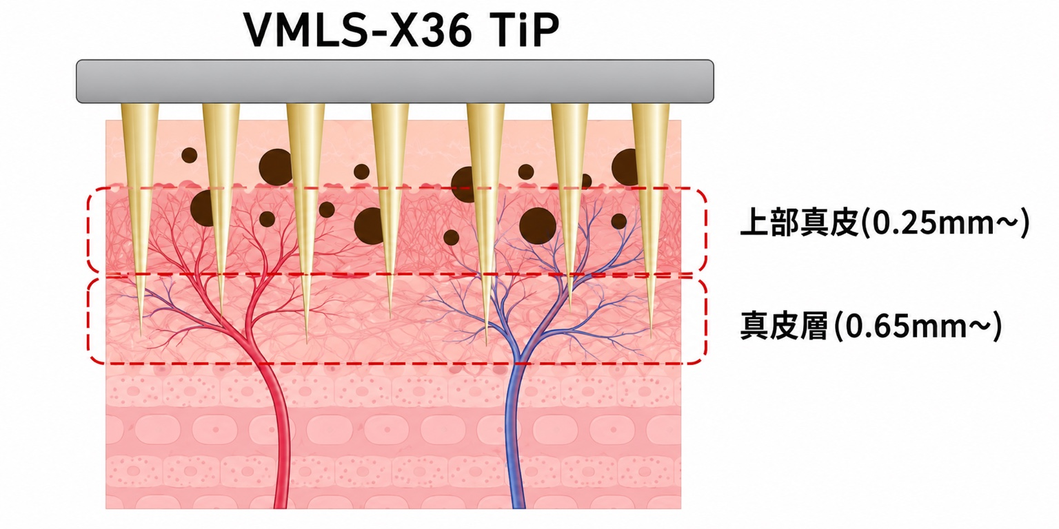 VMLS-X36 TIPの上部真皮と真皮層への作用模式図