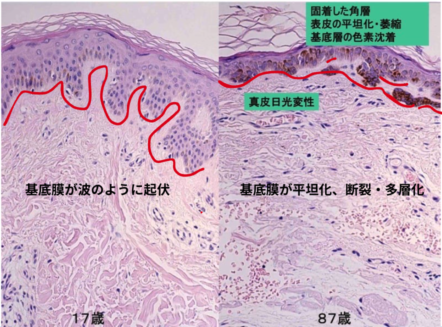若い皮膚と老化皮膚の基底膜の変化を比較した説明図