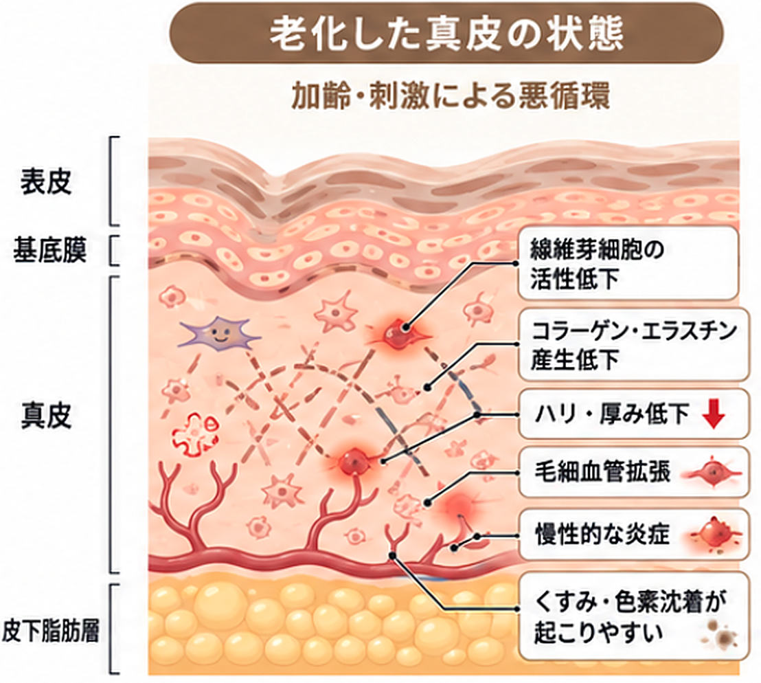 老化した真皮で線維芽細胞の活性低下、毛細血管拡張、慢性的な炎症が起こる説明図