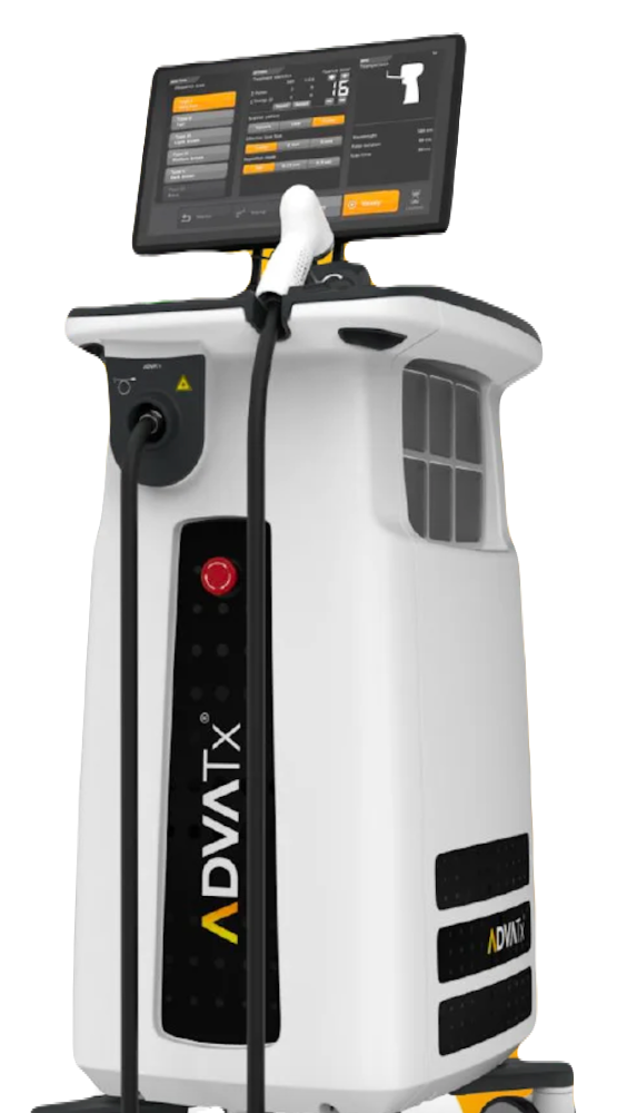 用於伴泛紅肝斑治療的ADVATx 雷射