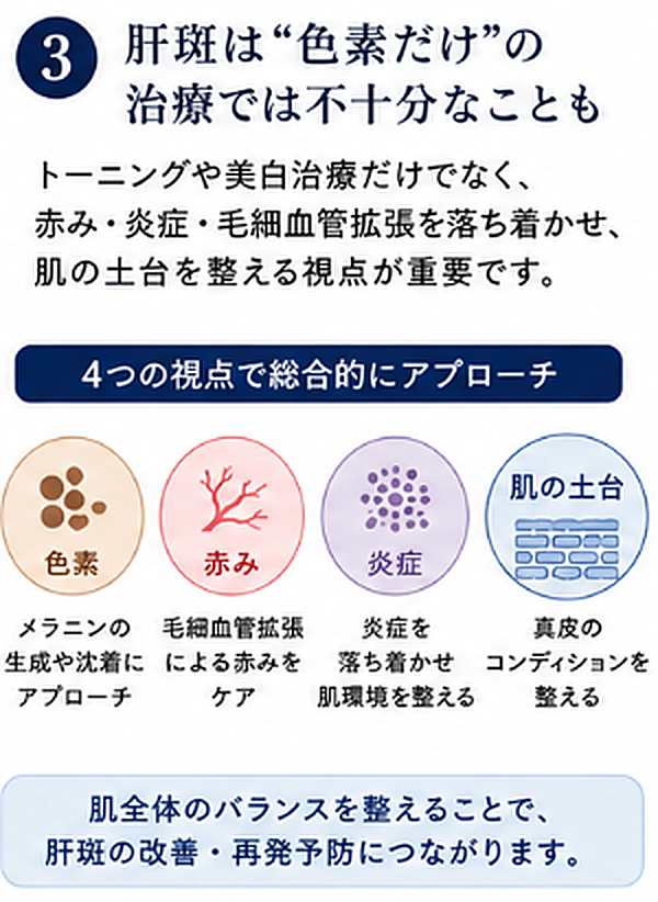 肝斑は色素だけでなく赤み炎症毛細血管拡張と肌の土台を整える視点が重要な説明図