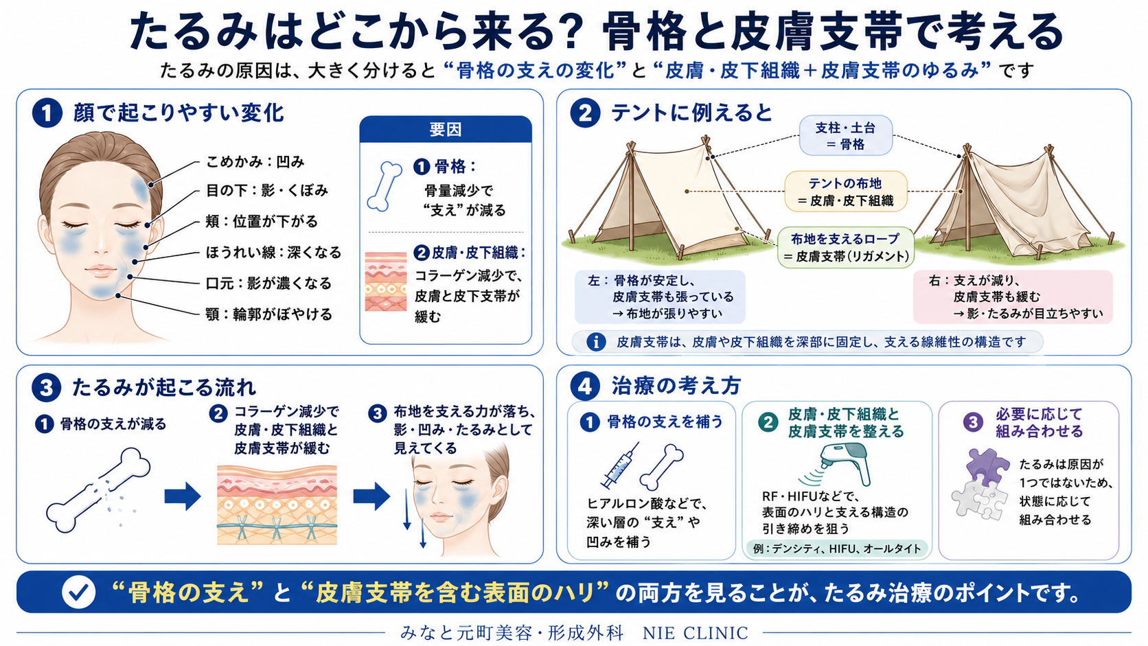 たるみの原因と治療の考え方を示した図解