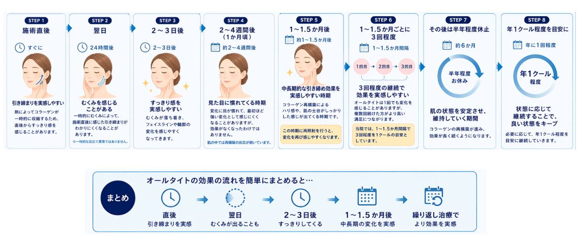 オールタイトの治療経過を示した図解