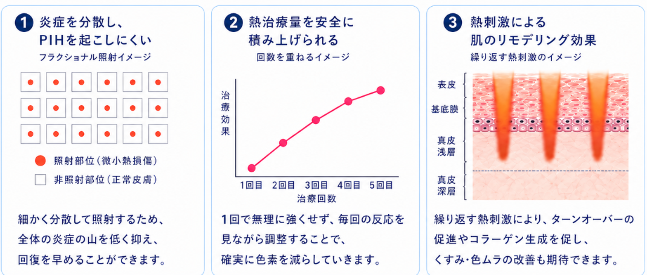 ルビーフラクショナルを複数回行う3つの考え方を示した図