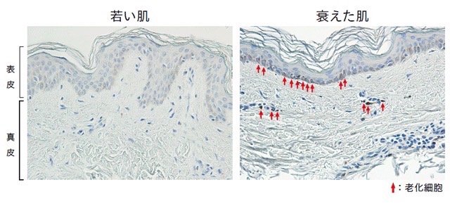 若い肌と衰えた肌の表皮・真皮を比較した肌老化の組織図