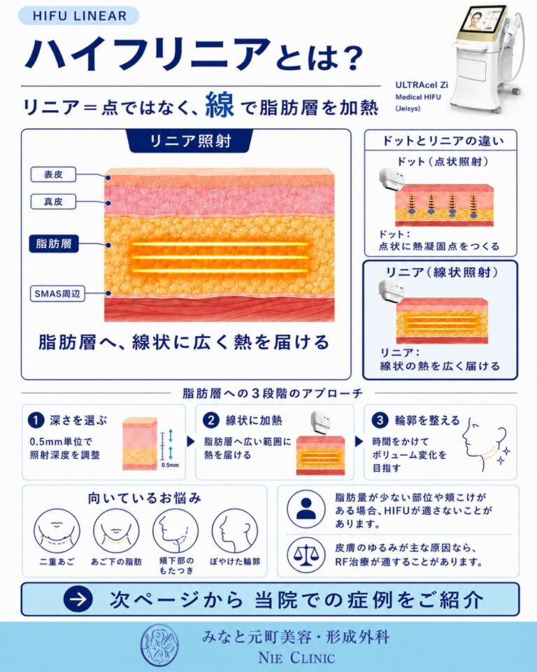 HIFUリニアの0.5mm単位の深度調整・脂肪層3段階加熱・ドット照射との違いを示す図解