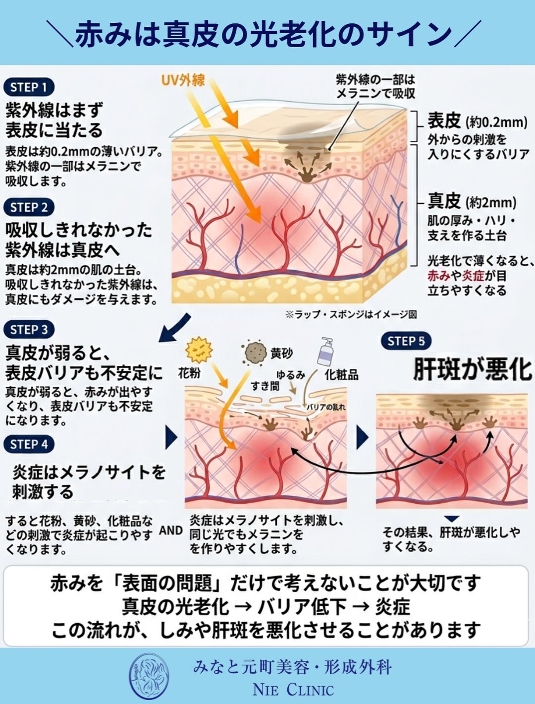 紫外線が表皮から真皮へ届き赤みとバリアへ影響する流れを示す図解