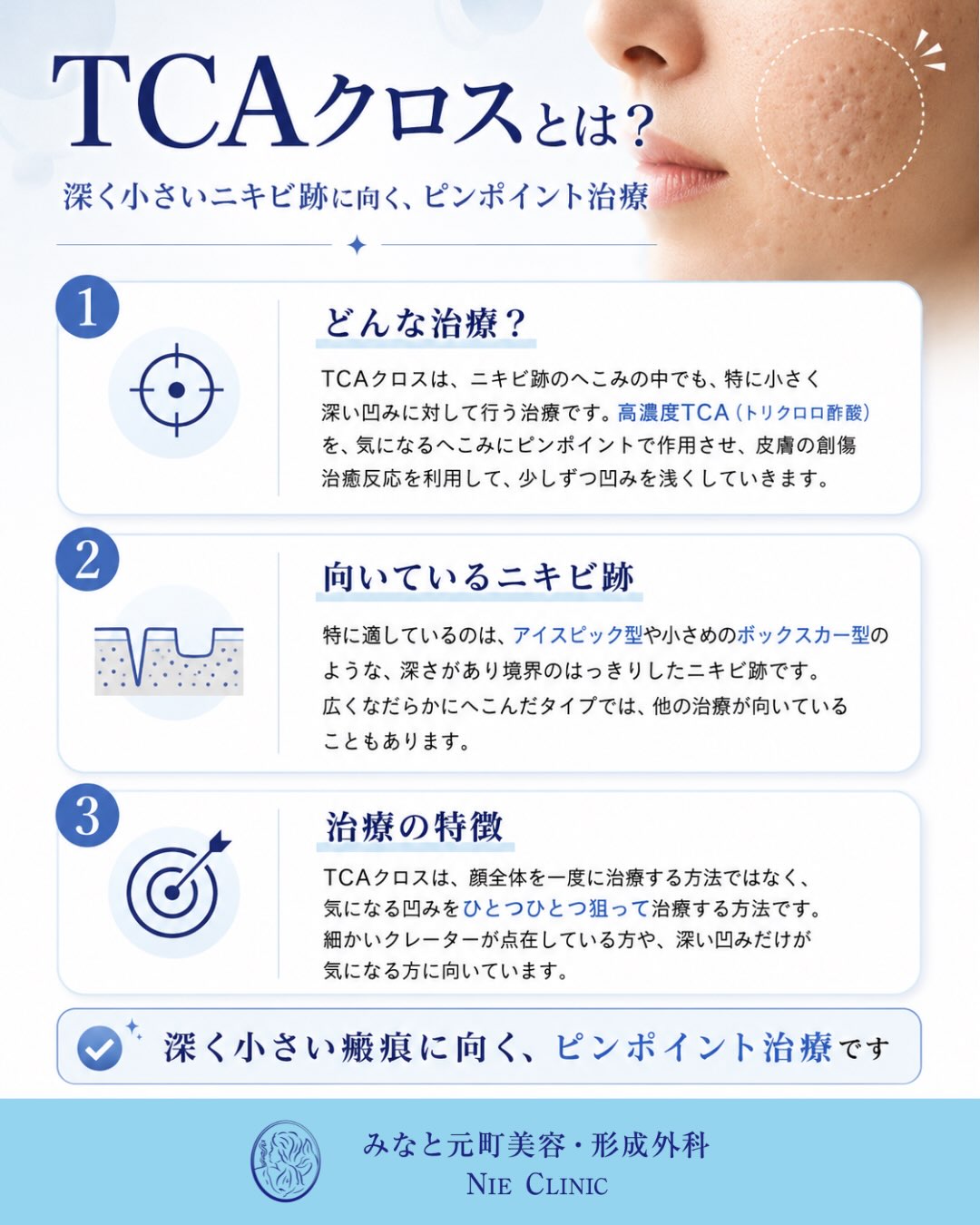 アイスピック型と小型ボックスカー型をTCA CROSSの対象として示す図解