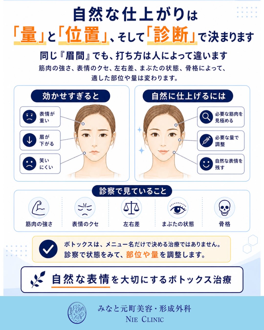 筋肉の強さ・左右差・まぶた・骨格から注入量と位置を決める図解