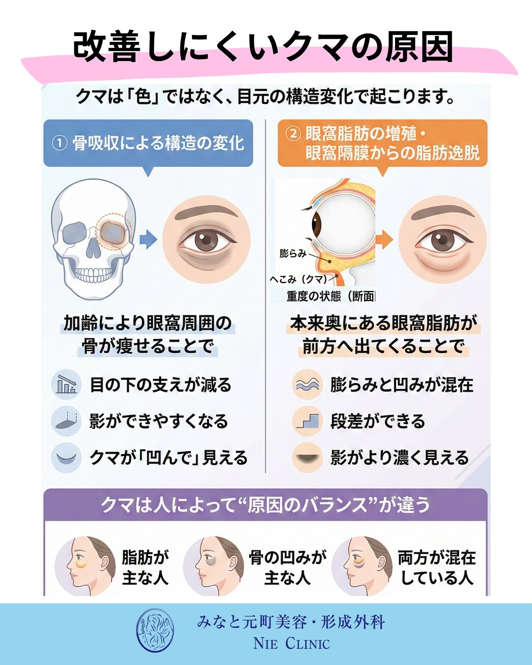 改善しにくいクマを骨吸収と眼窩脂肪突出に分ける図