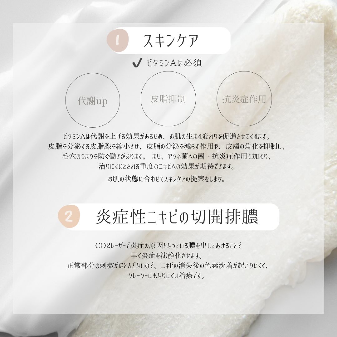 ビタミンAを使うスキンケアとCO2レーザーによる炎症性ニキビの切開排膿を説明した図